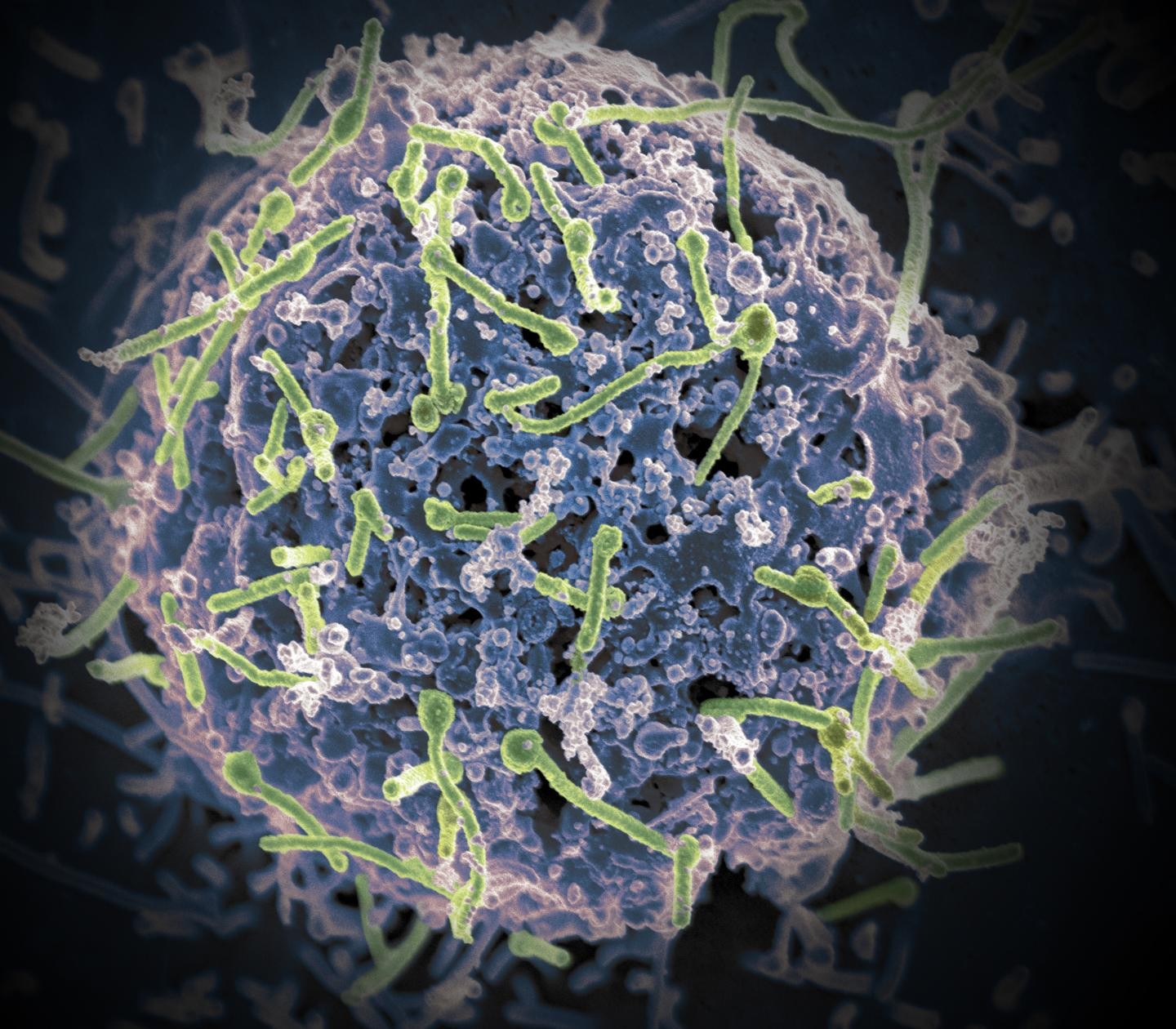 Nova vacina demonstra eficácia contra 4 tipos de vírus que causam ebola (Foto: NIAID)