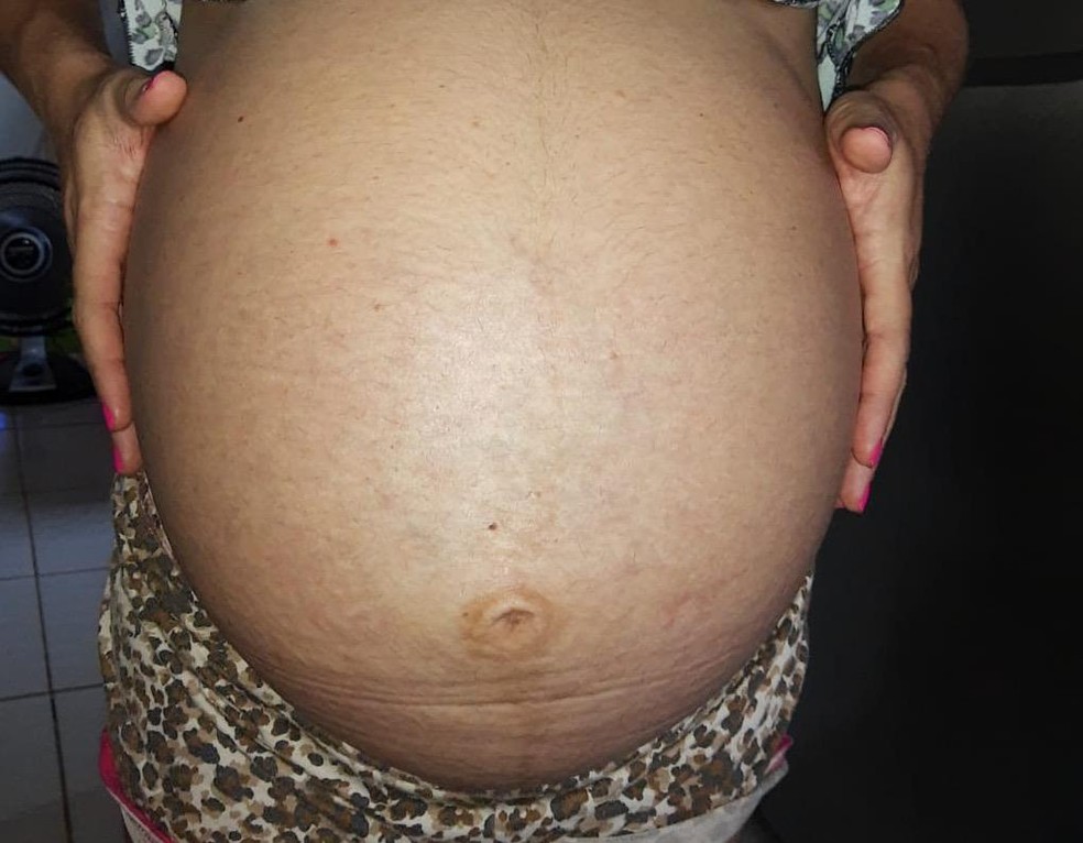 Três semanas antes do parto, Aline registrou como estava o tamanho da barriga — Foto: Arquivo pessoal