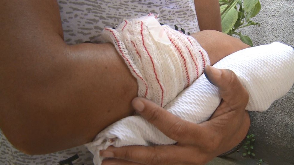 Mulher ficou ferida no braço ao tentar proteger o filho — Foto: Reprodução/ TV Gazeta