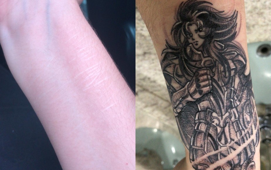Tatuador resgata autoestima de mulheres transformando cicatrizes em 'obras de arte' em MG