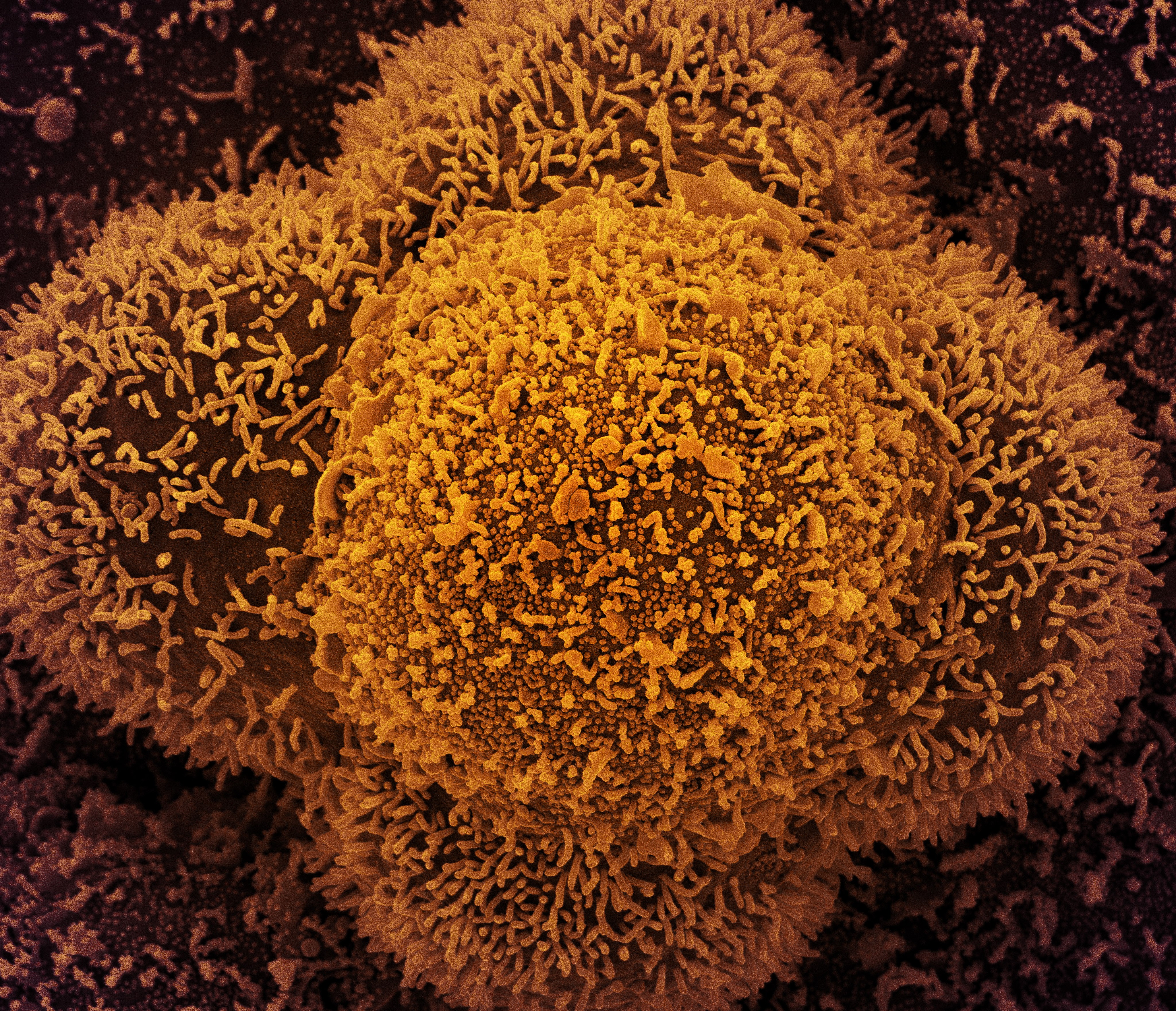 Células CCL-81 fortemente infectadas com partículas do vírus Sars-CoV-2, o vírus causador da Covid-19. As pequenas estruturas esféricas no centro da imagem são partículas do novo coronavírus, enquanto as protrusões semelhantes a fios que se estendem das c (Foto: Centro de Pesquisa Integrada (IRF) do NIAID )