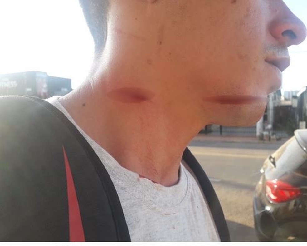 Motociclista ficou com ferimentos no pescoço e queixo ao ser atingido por linha de cerol em Rio Branco — Foto: Divulgação/Polícia Militar do Acre (PM-AC)