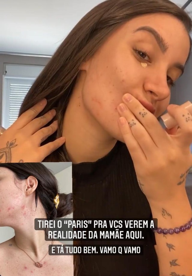 Bianca Andrade mostra a pele com acne (Foto: Reprodução/Instagram)