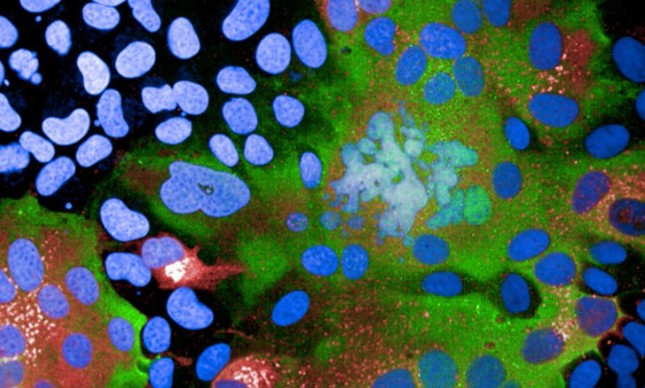 Pigmento especial de laboratório revela áreas onde variante delta do coronavírus invadiu células num experimento (verde)