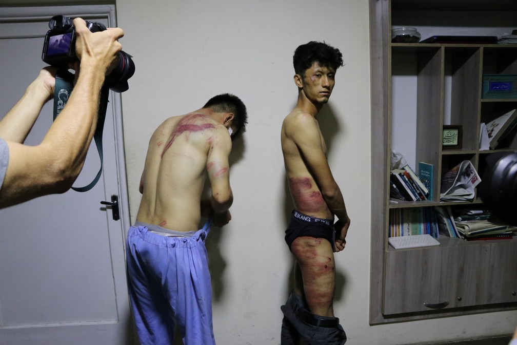Jornalistas mostram ferimentos após serem espancados pelo Talibã em Cabul, Afeganistão. Foto tirada em 8 de setembro de 2021 — Foto: Etilaatroz/via Reuters