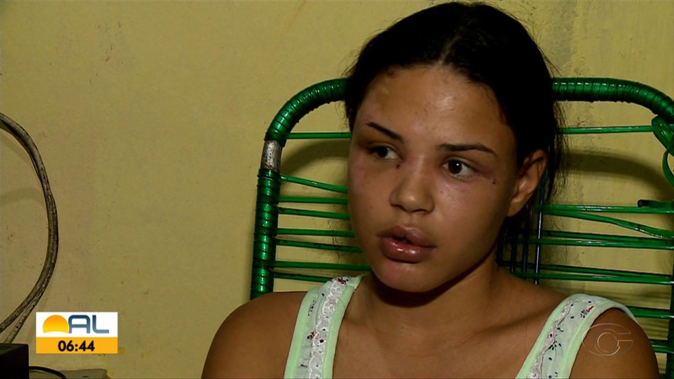 Maria Vitória Vieira, 20, se recupera em casa depois das agressões do namorado — Foto: Reprodução/TV Gazeta