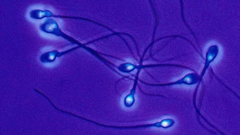 Os espermatozoides são fabricados de forma contínua a partir da puberdade (Foto: GETTY IMAGES via BBC)