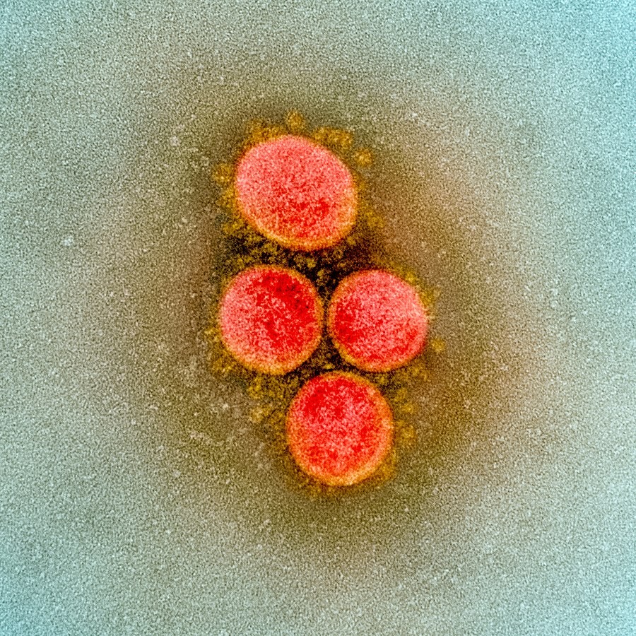 coronavírus sars-cov-2 (Foto: NIAID)
