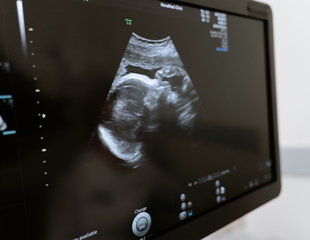 Através da placenta, pesquisadores dizem que é possível identificar gestantes que correm risco de complicações graves  (Foto:  MART PRODUCTION/Pexels)