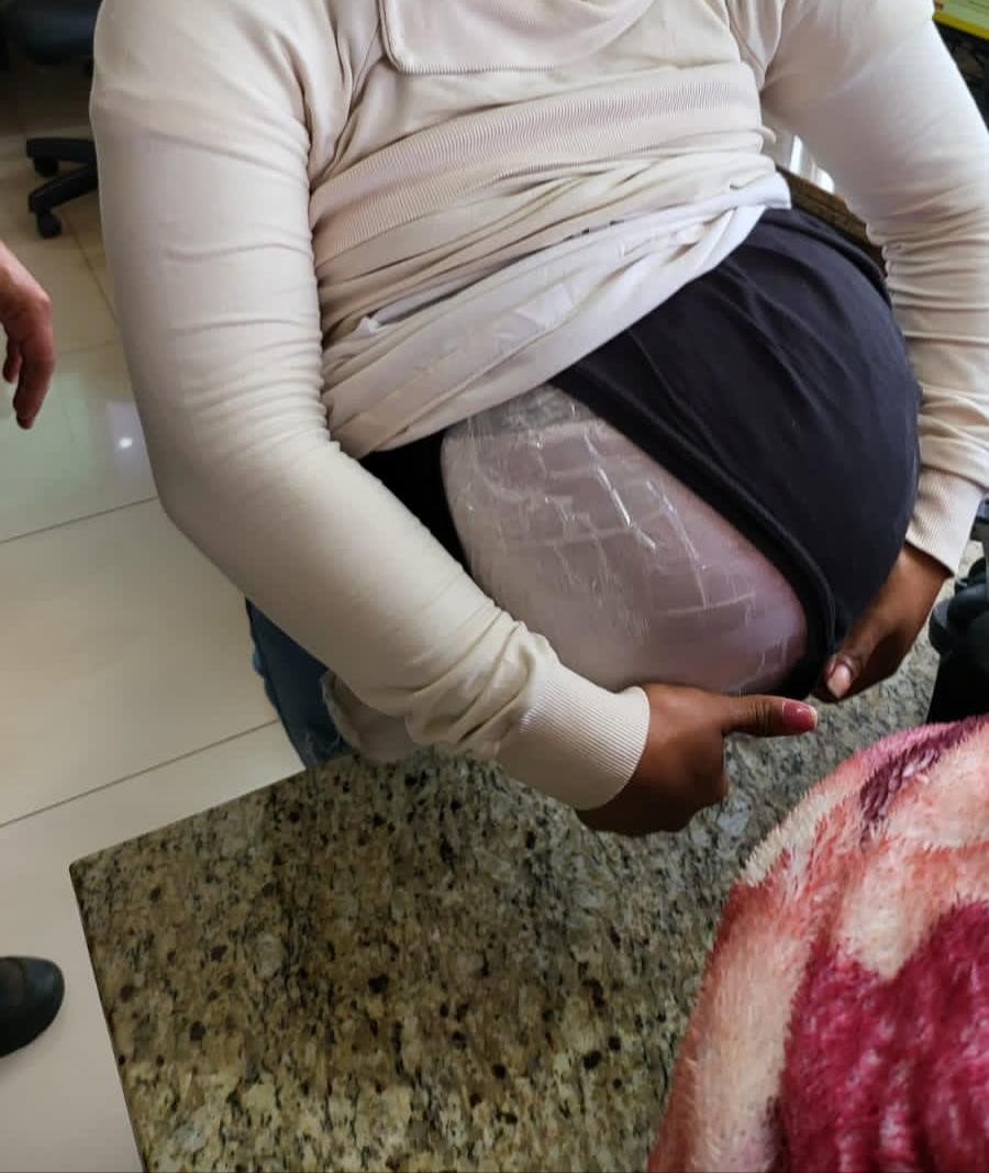 VÍDEO: 'Falsa grávida' é presa com sementes de maconha na barriga, em Foz do Iguaçu