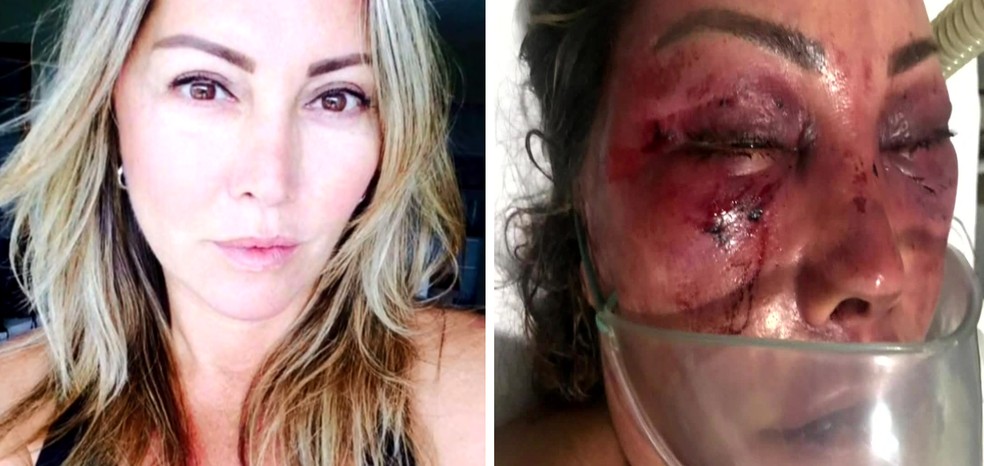 Elaine Perez Caparroz antes e depois das agressões — Foto: Reprodução/TV Globo