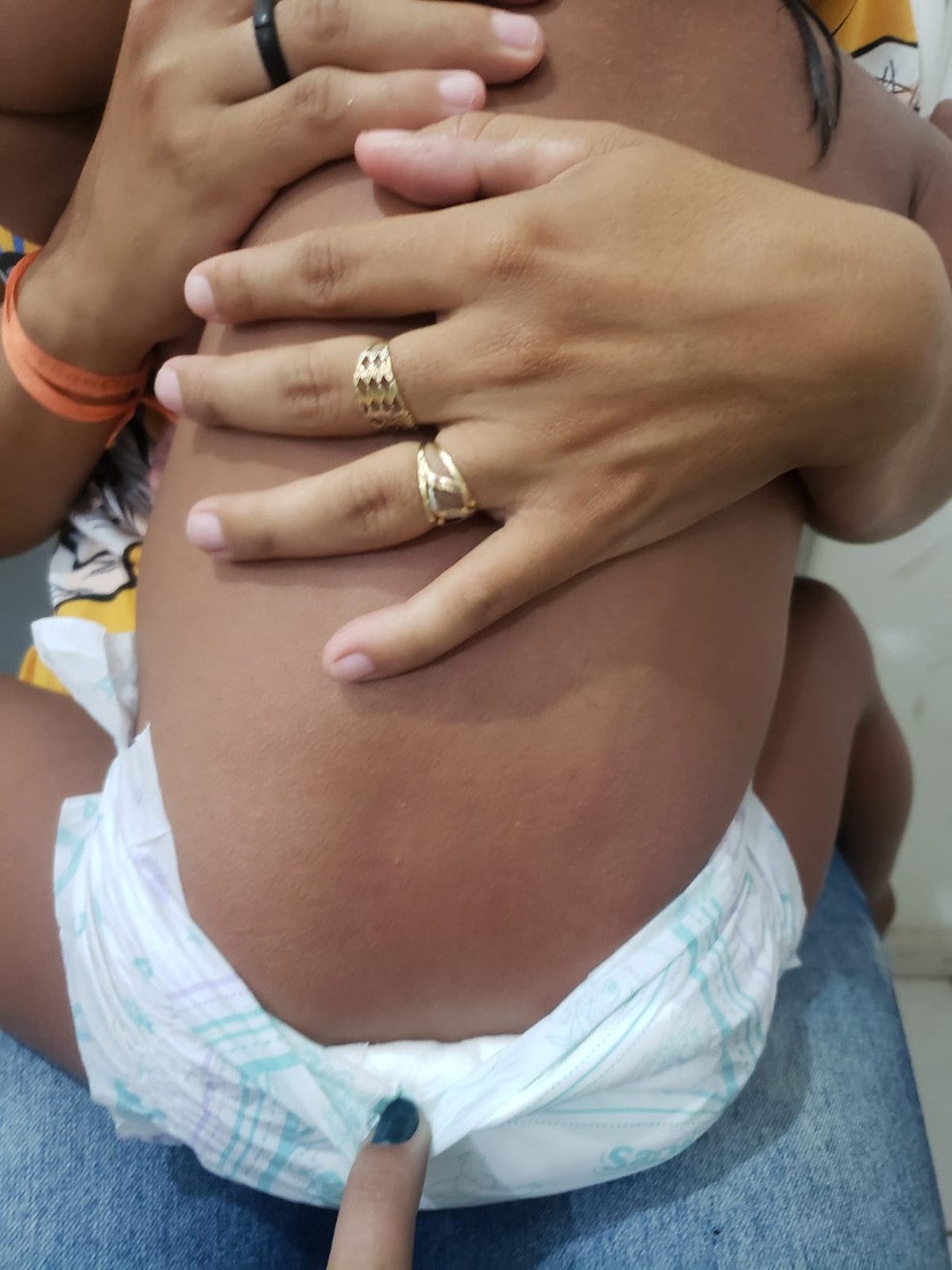 Bebê venezuelano foi encontrado com hematomas no rosto e nas costas em setembro deste ano — Foto: Divulgação/ Conselho Tutelar
