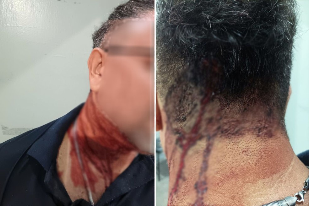 Funcionário de penitenciária é agredido por criminosos ao tentar conter fuga no litoral de São Paulo — Foto: Reprodução