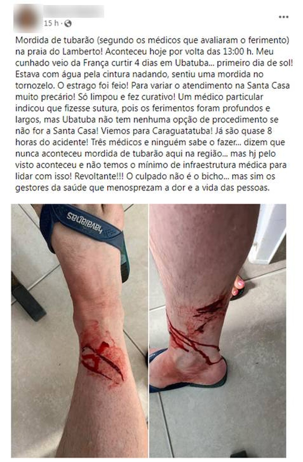 Em post, familiar contou que turista teria sido atacado por tubarão — Foto: Reprodução/Facebook