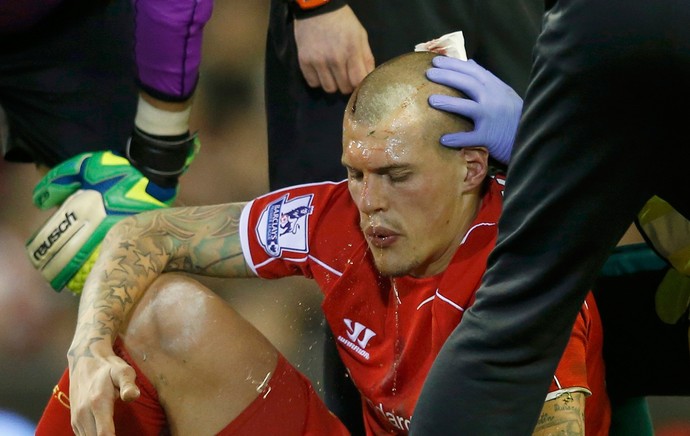 skrtel machuca cabeça Liverpool (Foto: Reuters)