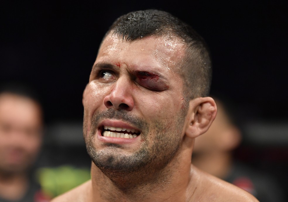 Rodolfo Vieira terminou a luta com o olho esquerdo completamente fechado — Foto: Getty Images