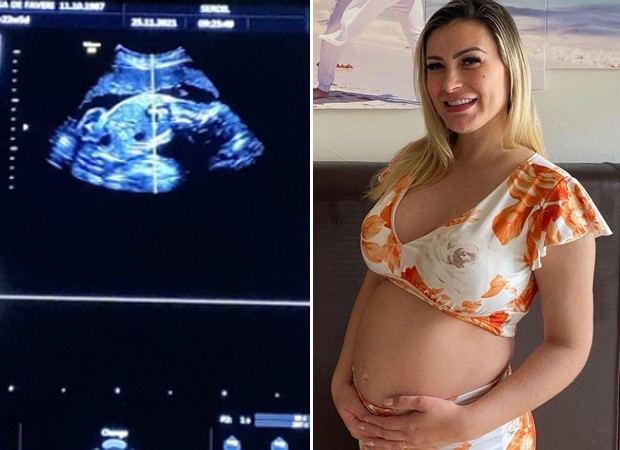 Andressa Urach mostra ultrassom de filho (Foto: Reprodução Instagram)
