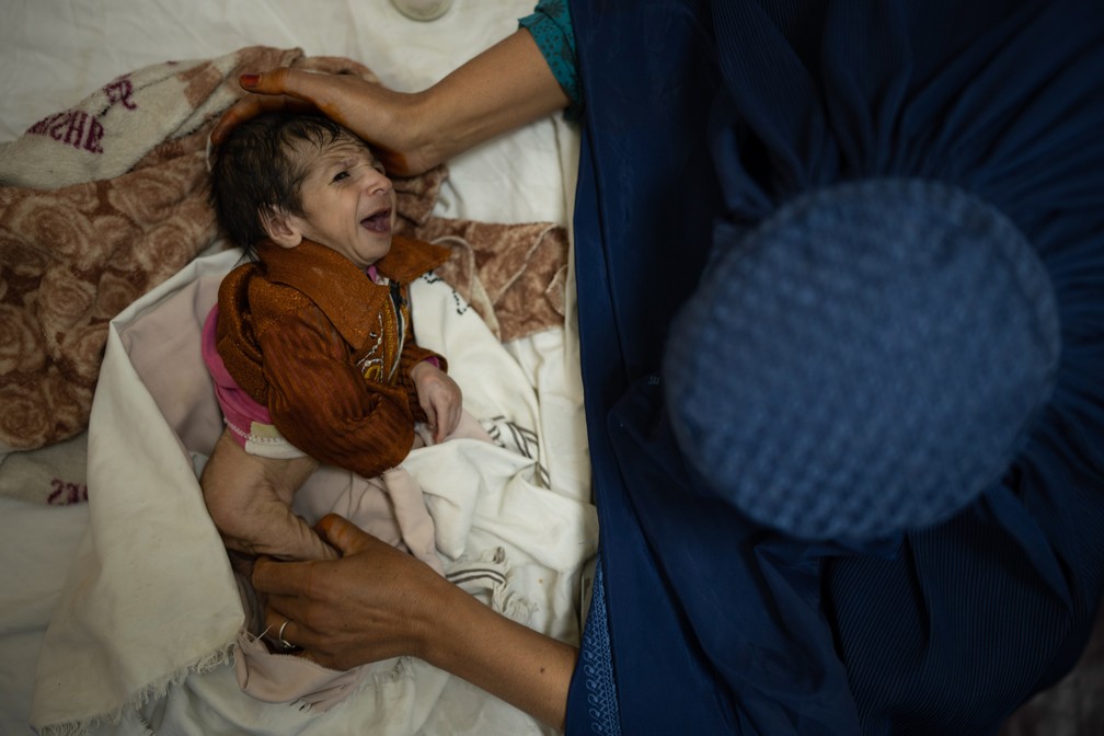 5 de outubro - Sofia segura Abdul, seu bebê de 2 meses, durante um tratamento para desnutrição na enfermaria do Hospital Infantil Indira Gandhi em Cabul, no Afeganistão   — Foto: Felipe Dana/AP
