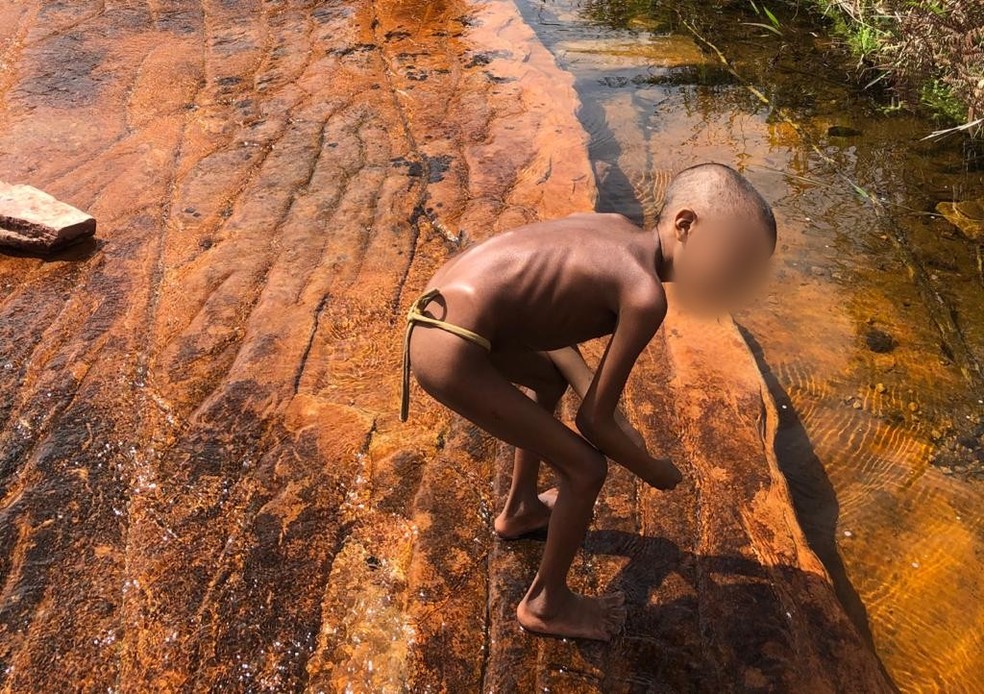 Menino de 9 anos foi resgatado em março, na comunidade Surucucu, Terra Indígena Yanomami  — Foto: Divulgação/Condisi-YY