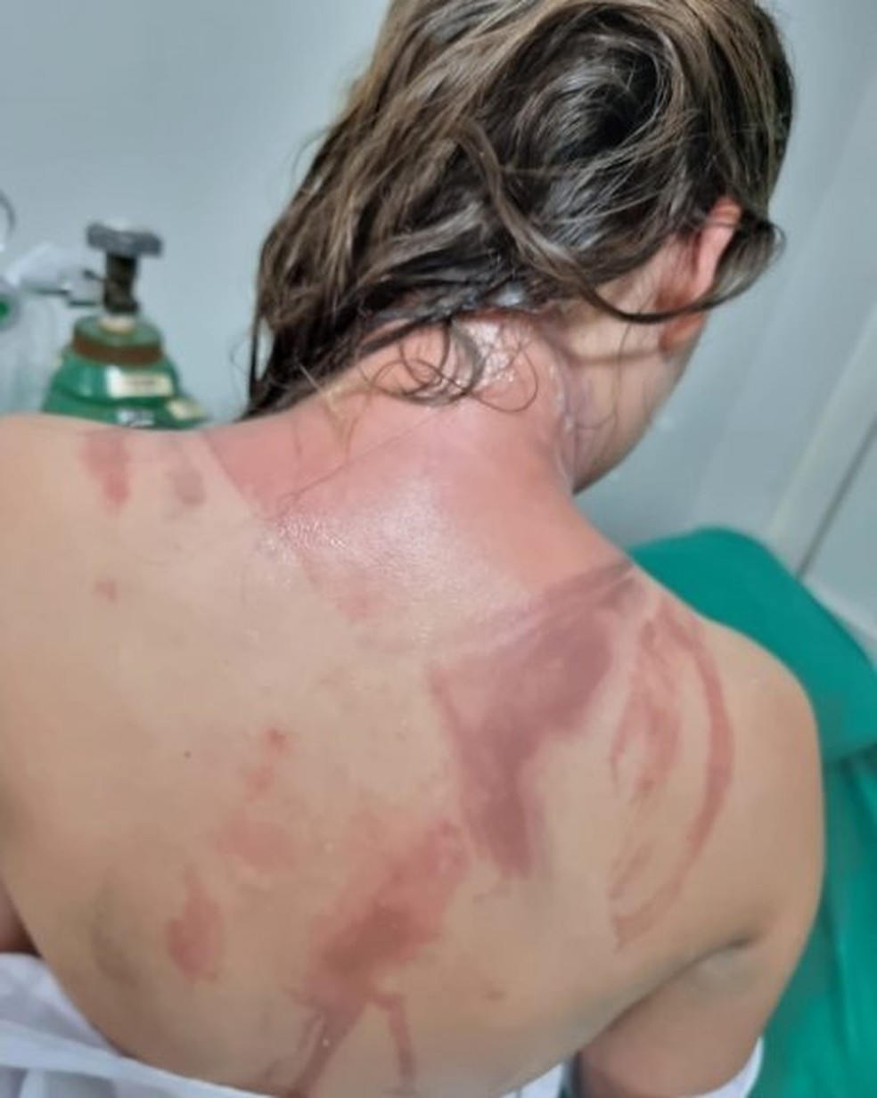 Estudantes da UFPR de Palotina são feridos em trote com creolina — Foto: Correio do Ar