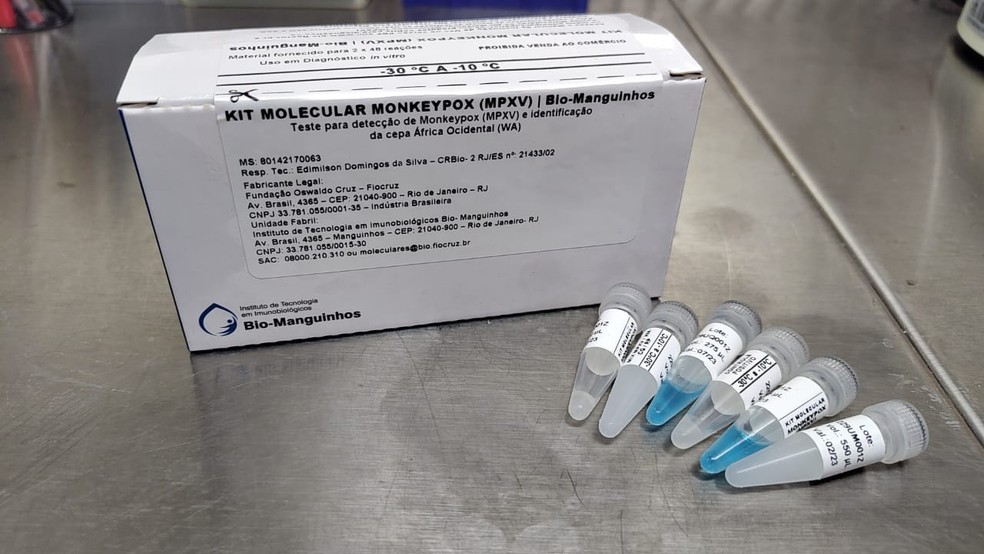 Laborat&oacute;rio central do Tocantins come&ccedil;a a fazer exames para diagnosticar  monkeypox | Tocantins | G1