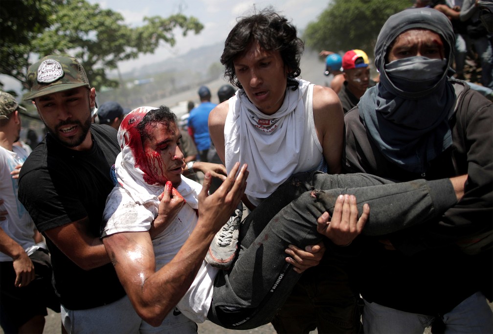 Ferido, manifestante prÃ³-GuaidÃ³ Ã© carregado com sangue na cabeÃ§a por colegas apÃ³s ser atropelado por um veÃ­culo militar perto da base aÃ©rea 'La Carlota', durante confronto em Caracas â€” Foto: Ueslei Marcelino/Reuters