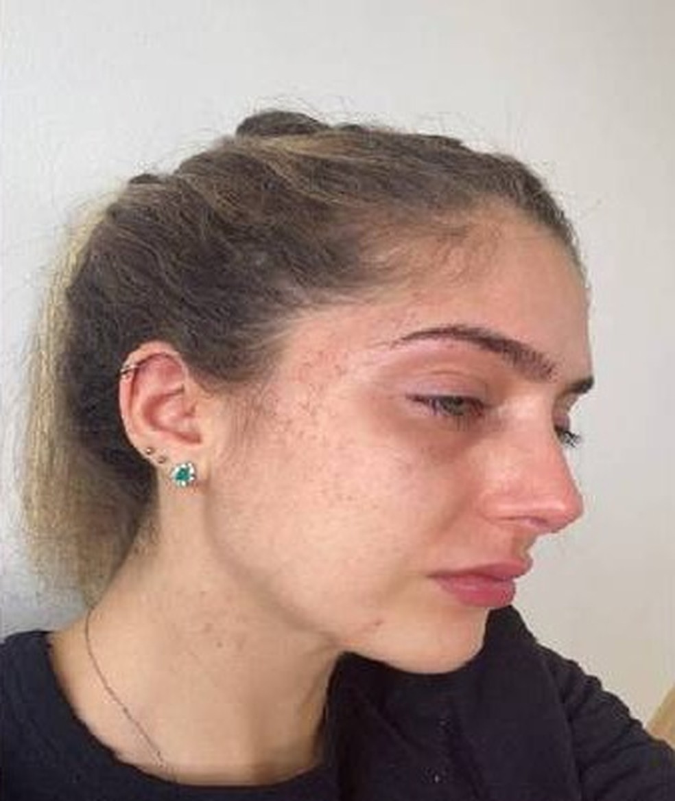 Gabriela Campos Duarte Machado, de 23 anos, foi agredida pelo ex-namorado — Foto: Reprodução