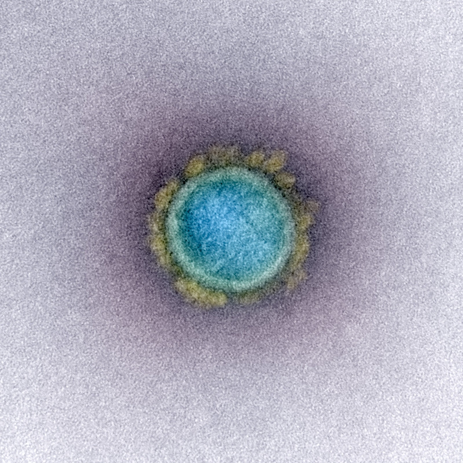 coronavirus sars-cov-2 covid-19 (Foto: NIH/NIAID)