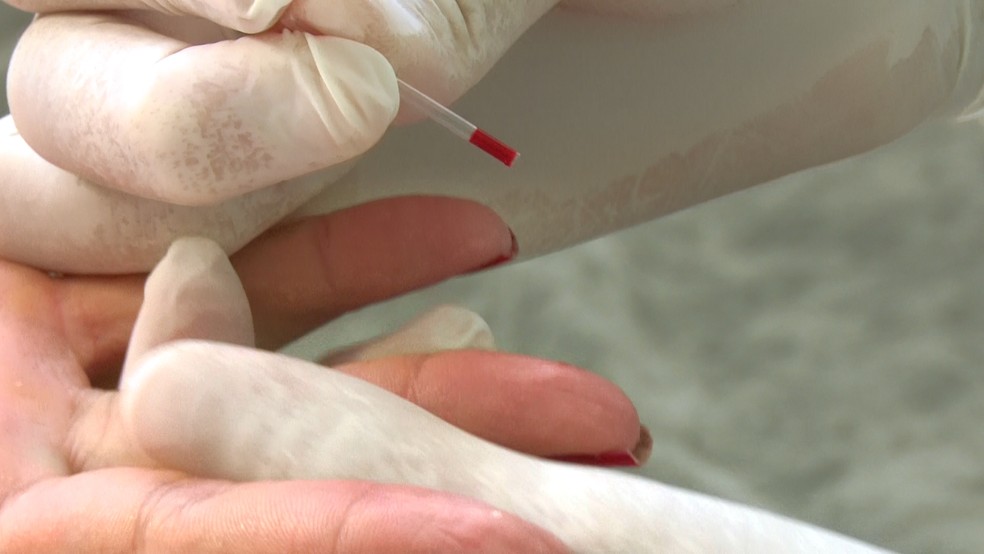 Teste rÃ¡pido de sÃ­filis, HIV e hepatites detecta vÃ­rus no organismo  â€” Foto: ReproduÃ§Ã£o/Rede AmazÃ´nica