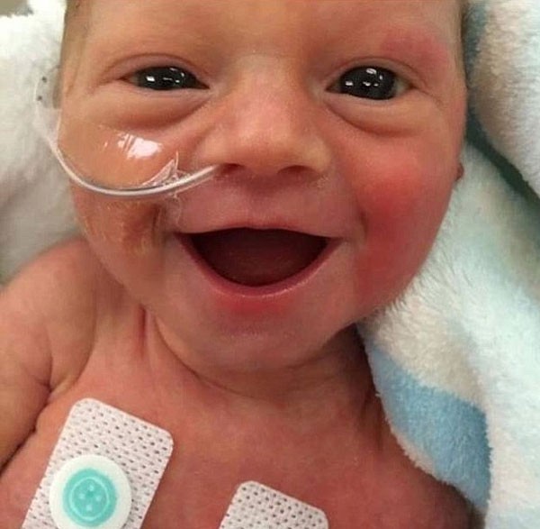 Bebê prematura sorri no quinto dia de vida (Foto: Reprodução Facebook)