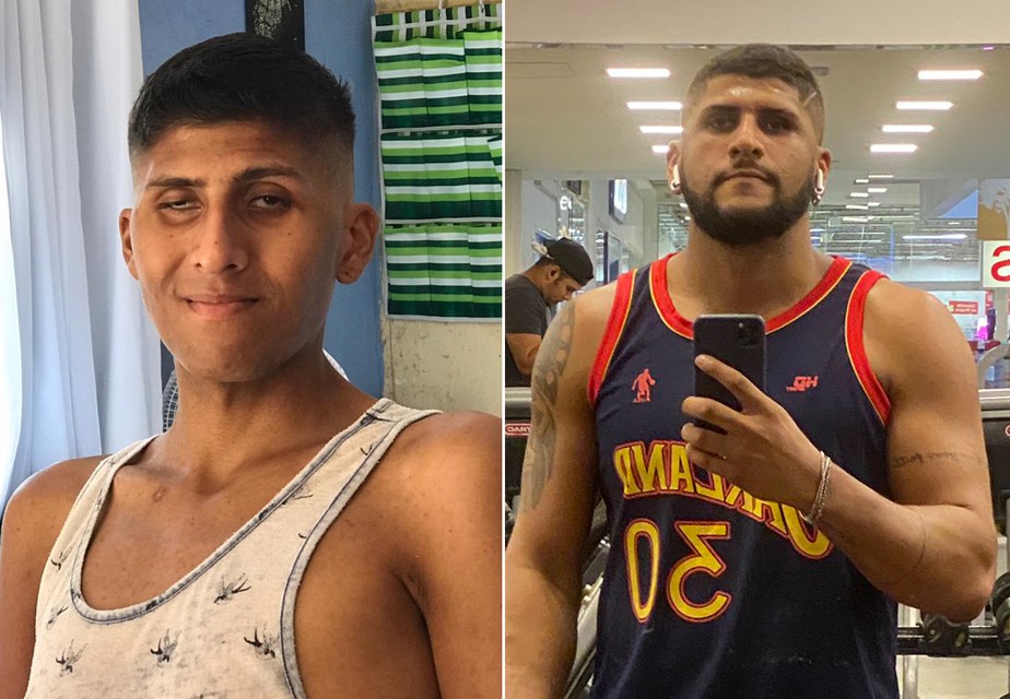 Influencer Vitor Ramos antes e depois de tratamento contra HIV
