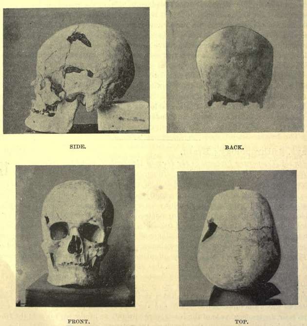 Possível crânio de Sanakht (Foto: Wikimedia Commons)