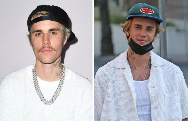 Justin Bieber durante a crise da doença de Lyme e após superar o problema (Foto: Reprodução / Instagram)