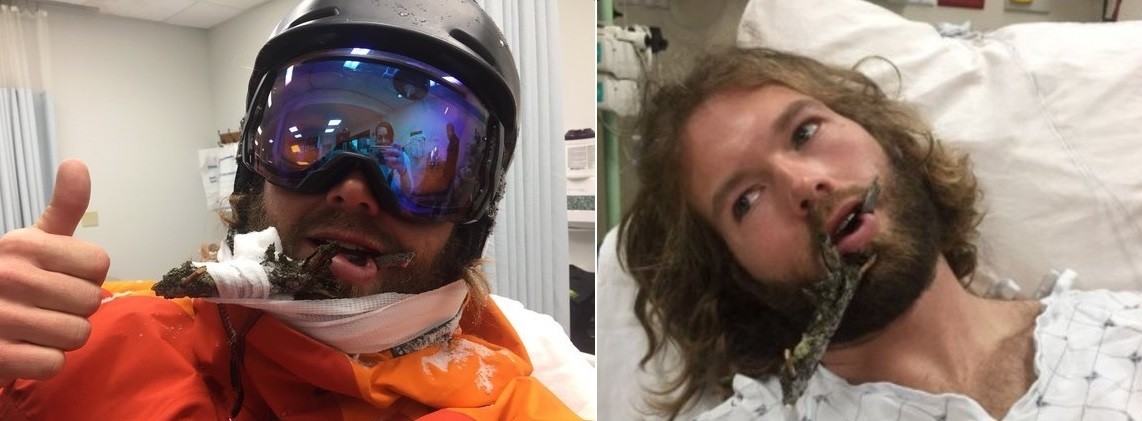 Natty logo após o acidente e no hospital