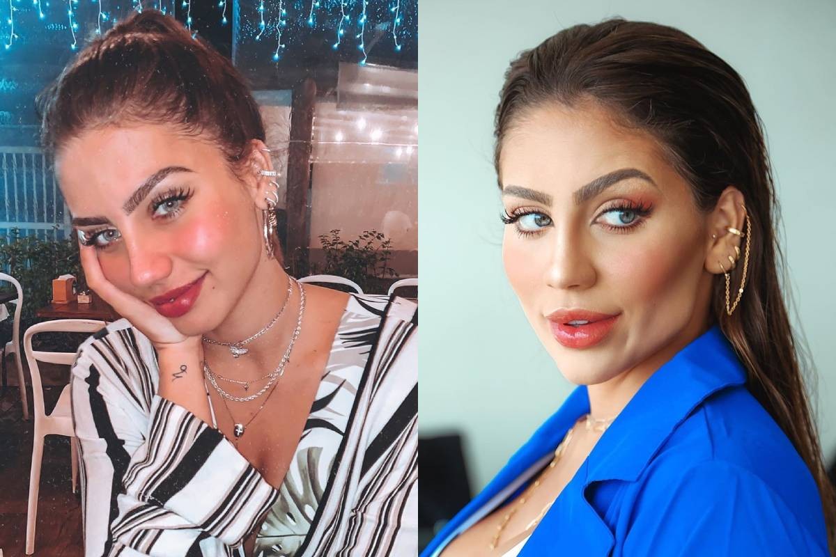 Catherine Bascoy antes e depois de harmonização facial (Foto: Reprodução/Instagram)