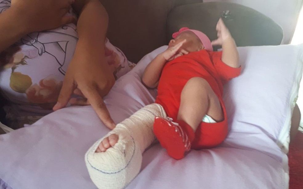 BebÃª teve perna fraturada durante parto, em hospital no sul da Bahia (Foto:  Giro IpiaÃº)