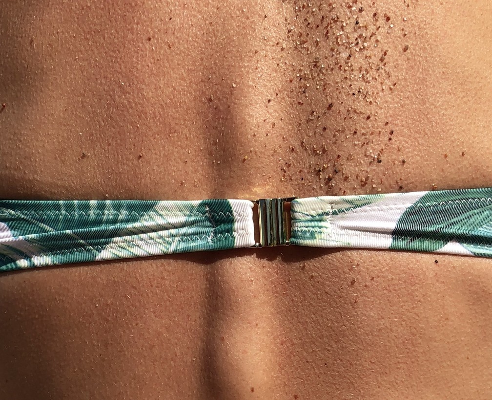 O câncer de pele é o mais frequente no Brasil, segundo o Instituto Nacional do Câncer (imagem ilustrativa) — Foto:  Kristaps Grundsteins / Unsplash / Divulgação