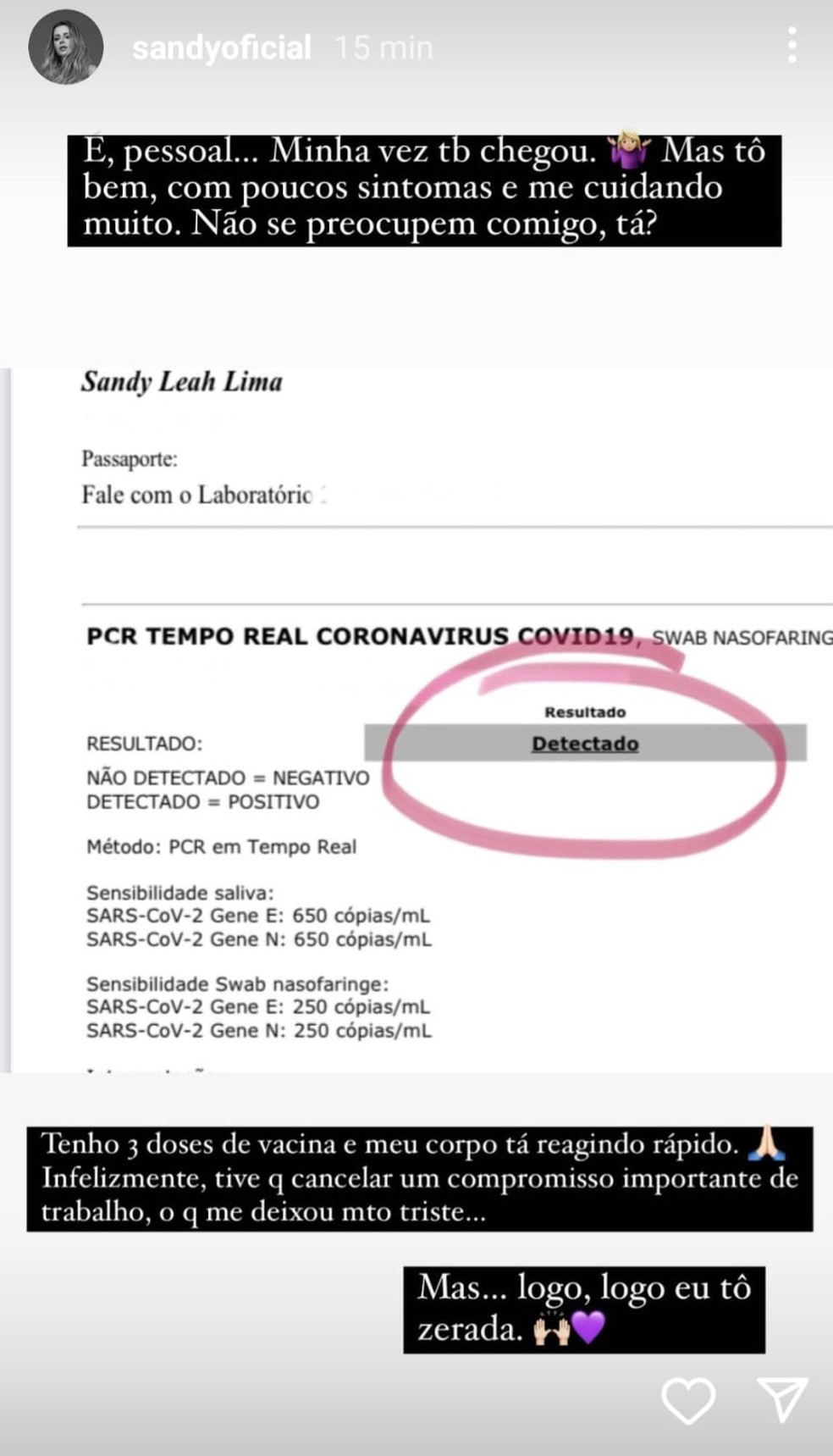 Sandy testa positivo para Covid-19 — Foto: Reprodução/Instagram