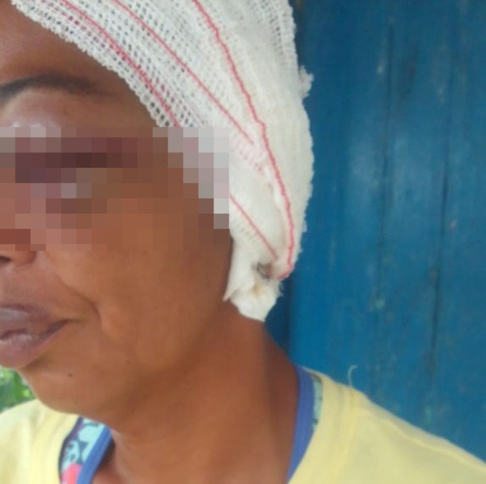 Mulher é agredida e tem orelha arrancada por filho e nora na Bahia — Foto: Arquivo pessoal
