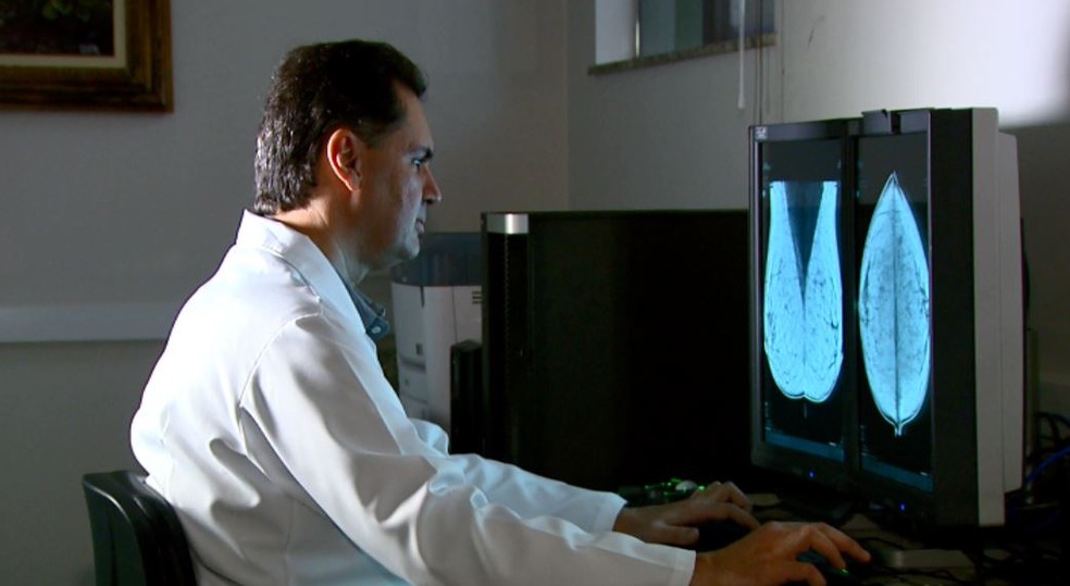 Mamografia é a forma mais eficaz de fazer o diagnóstico precoce de câncer de mama (Foto: Rodrigo Sargaço/EPTV)