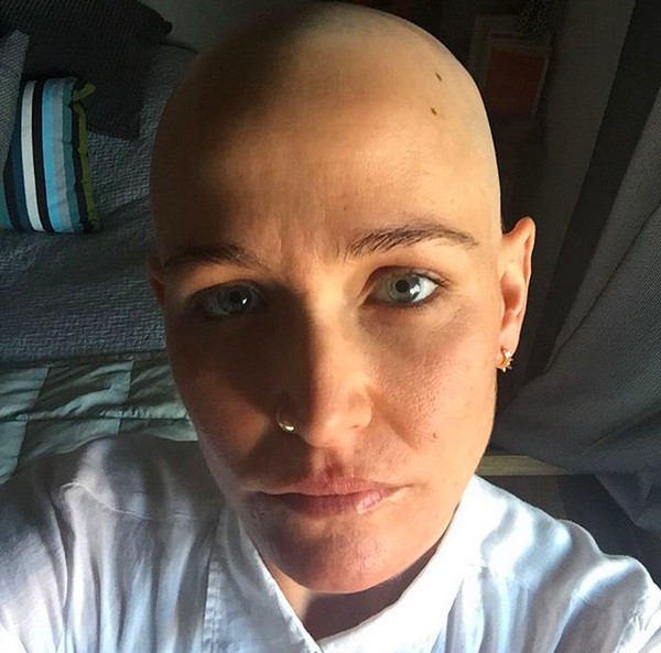 A diretora de fotografia Bianca Butti durante seu tratamento (Foto: Instagram)
