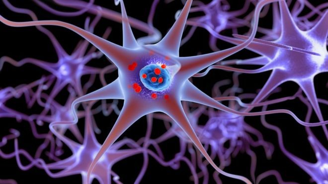 BBC - Ilustração mostra neurônios e, dentro deles, em vermelho, depósitos de alfa-sinucleína acumulados; falhas no funcionamento das células em seu início foram detectadas, o que ajuda a explicar o Parkinson (Foto: Getty Images via BBC News)