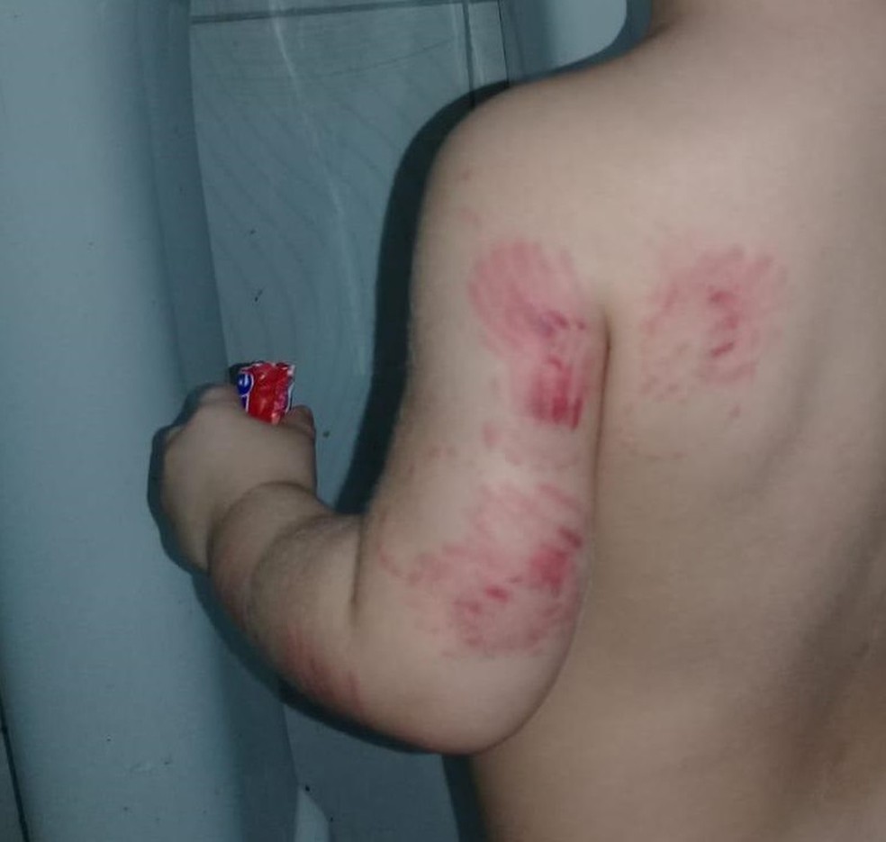 Mãe denuncia que filho foi vítima de maus-tratos em creche de Fortaleza — Foto: Arquivo Pessoal