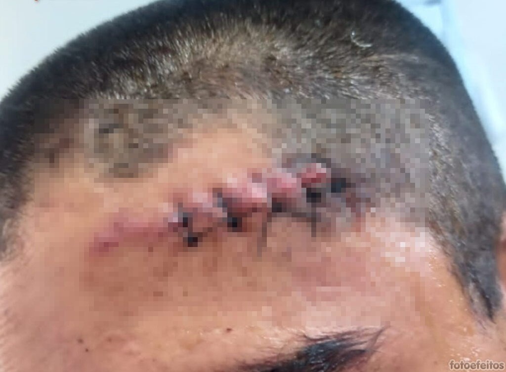 Presos suspeitos de agredir policial a pedradas no Centro de Teresina