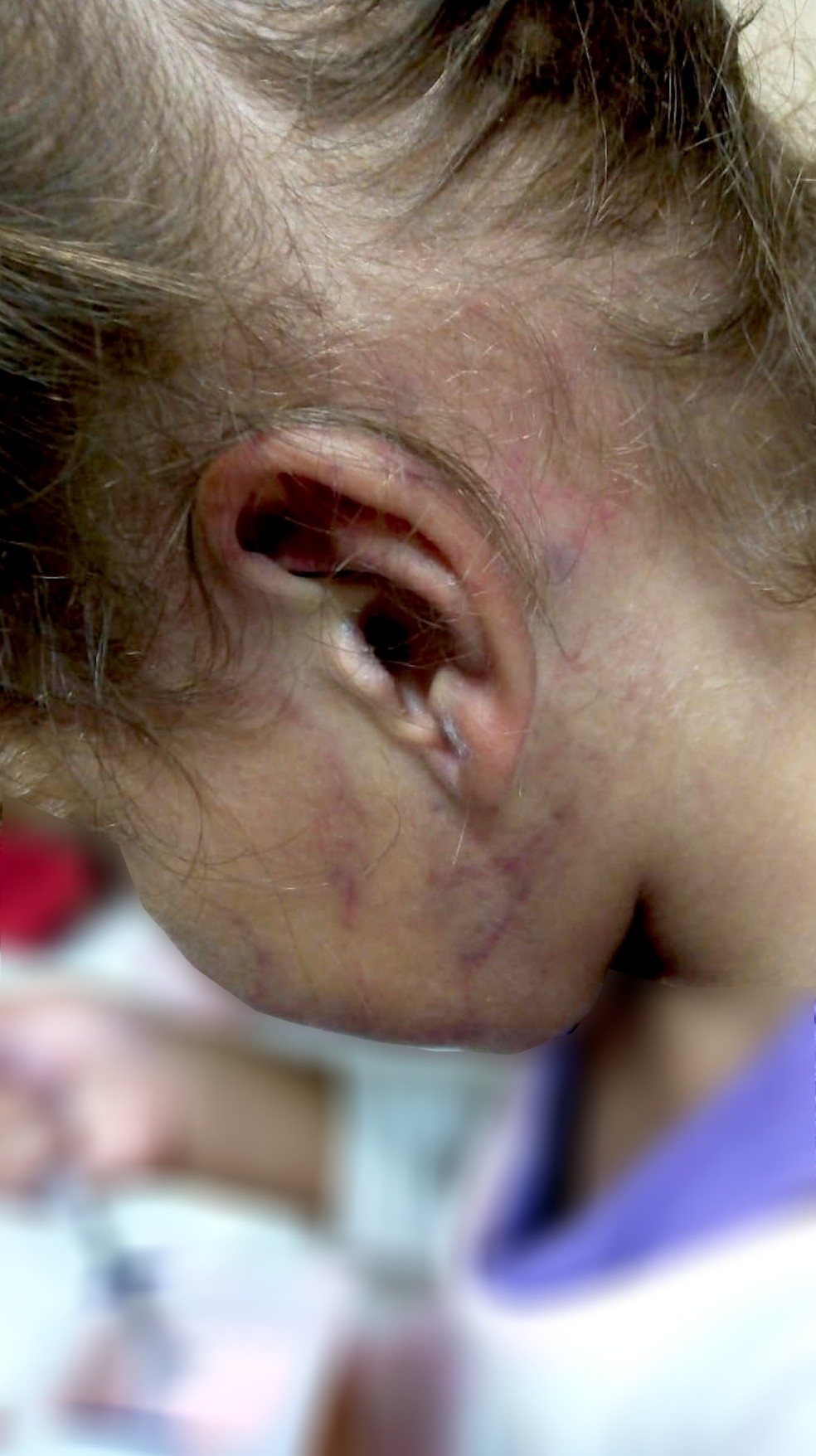 Polícia Civil investiga denúncia de agressão contra menina de 2 anos em creche de São José dos Campos — Foto: Arquivo pessoal