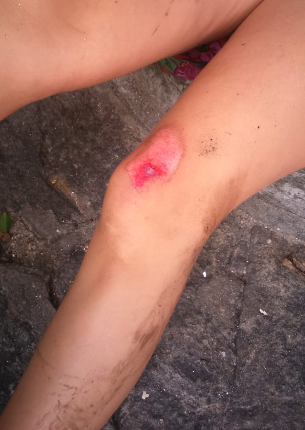 Turista alemã é atropelada durante bloco no Centro do Rio — Foto: Felipe Araujo/Arquivo pessoal