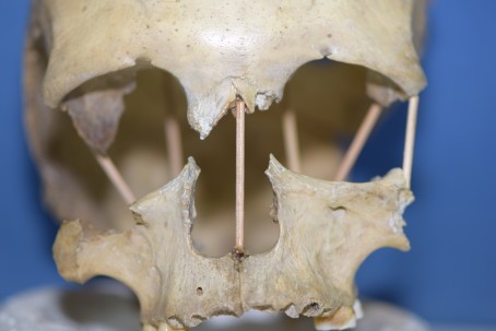 Crânio de Pestera Muierii 1, mulher que viveu há 35 mil anos na região atual da Romênia  (Foto: Mattias Jakobsson/ Universidade de Uppsal )