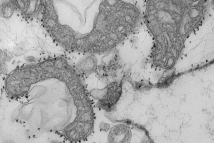 Teste que avalia DNA mitocondrial pode prever gravidade de Covid-19. Acima: Mitocôndrias danificadas (áreas cinza-escuras) liberadas dos pulmões humanos. Os pequenos pontos escuros ao redor das mitocôndrias são esferas magnéticas que carregam anticorpos usados ​​para isolar e estudar mitocôndrias prejudiciais que foram liberadas de tecidos moribundos. (Foto: WANDY BEATTY/Washington University)