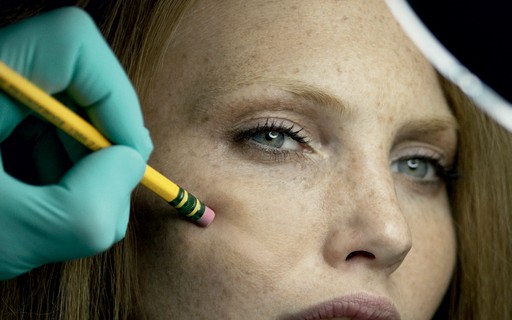 Caneta Permanente Na Pele Faz Mal O Fim Das Sardas Tratamento Elimina Pontinhos Da Pele Vogue Pele