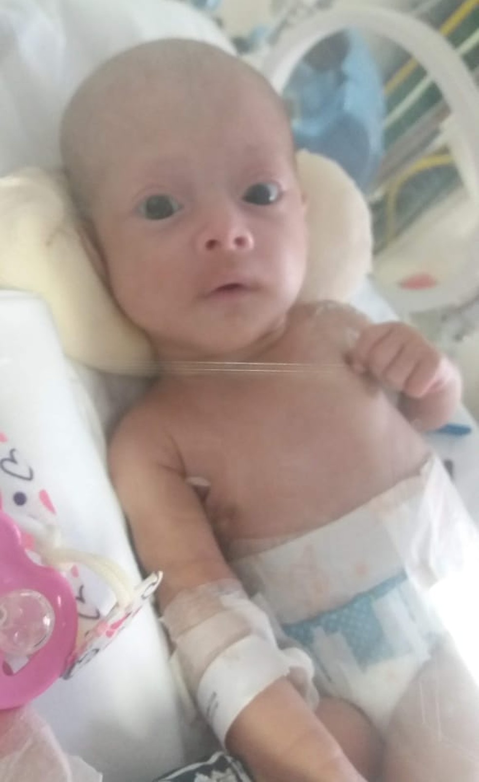 Recém-nascida teve uma parada cardiorrespiratória durante cirurgia para troca de válvula de drenagem — Foto: Arquivo Pessoal
